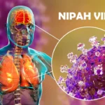 Le Virus Nipah, prochaine pandémie à l’horizon?