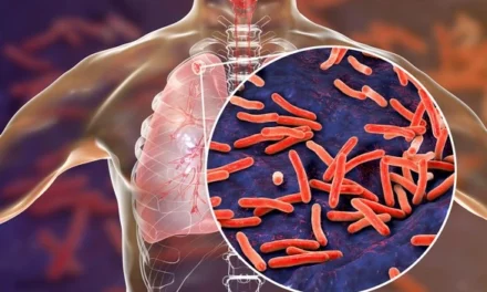Comment un gène méconnu du chromosome X influence notre lutte contre la tuberculose!