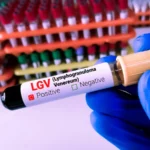 Lymphogranulomatose vénérienne : quelle est cette étrange IST qui sévit en France et en Europe ?