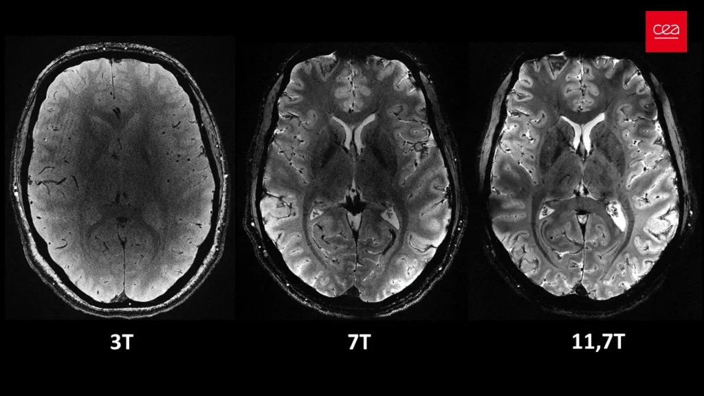 premiere-mondiale-lirm-le-plus-puissant-au-monde-revele-les-secrets-du-cerveau-h