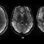 Première mondiale : l’IRM le plus puissant au monde révèle les secrets du cerveau humain