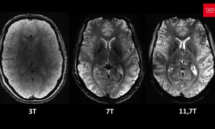 Première mondiale : l’IRM le plus puissant au monde révèle les secrets du cerveau humain