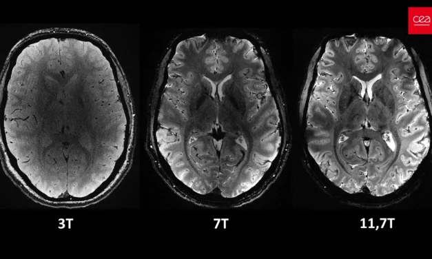 Première mondiale : l’IRM le plus puissant au monde révèle les secrets du cerveau humain