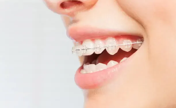 L’évolution de l’orthodontie au Canada : découvrez les nouvelles tendances