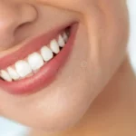 Comment retrouver un beau sourire ? Toutes les solutions pour des dents éclatantes !