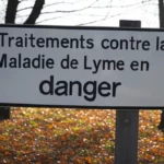 Maladie de Lyme : les traitements en danger après les décisions de la HAS et de l’Inserm