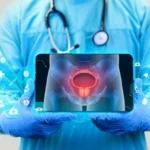 Cancer de la vessie : les nouveaux traitements qui sauvent des vies !