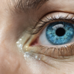Changer la couleur de ses yeux : attention à la kératopigmentation