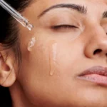 Microneedling à domicile : efficace et sûr ?