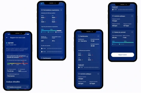 Apnée du sommeil : votre smartphone peut la détecter