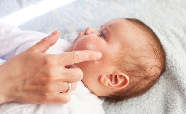 Eczéma du nourrisson : un lien prouvé avec le stress pendant la grossesse