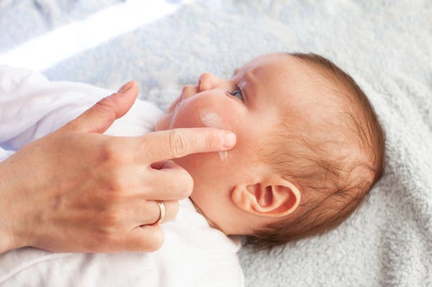 Eczéma du nourrisson : un lien prouvé avec le stress pendant la grossesse