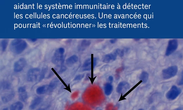 Cancer : une molécule qui redonne l’espoir de guérir