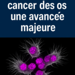 Vieillissement et cancer des os : une avancée majeure