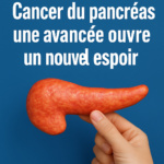 Cancer du pancréas : une avancée ouvre un nouvel espoir